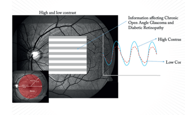 Therefore, electrophysiological tests not only provide information on where certain defects lie within in the neuro-visual pathway, but also what retinal cell types are dysfunctional. Such information offers a useful, totally objective addition to the oph