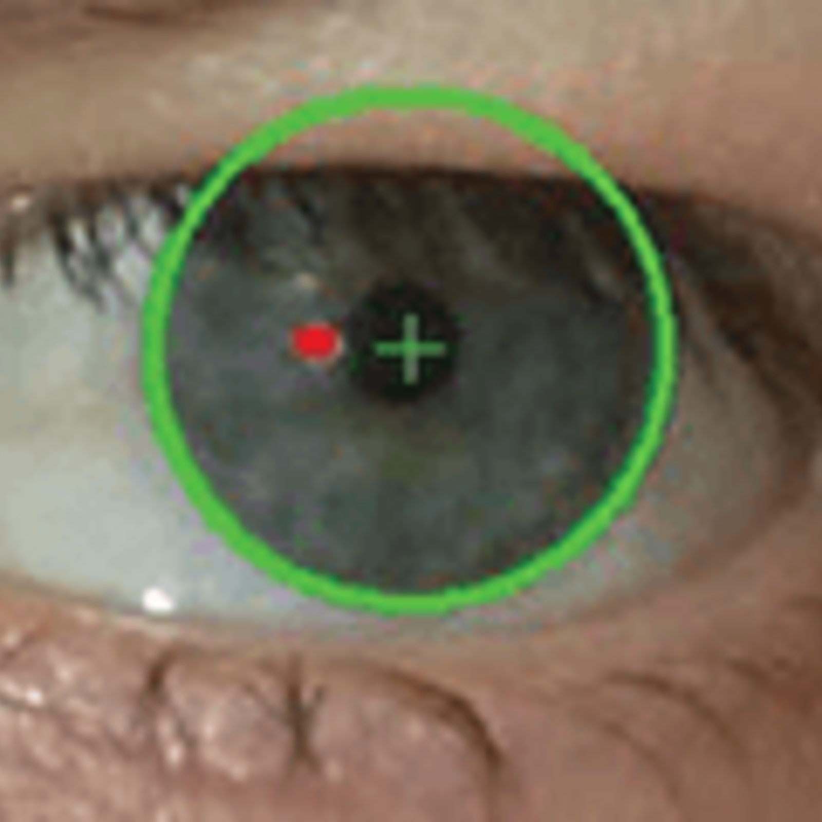 Strabismus Screening Now There S An App For That