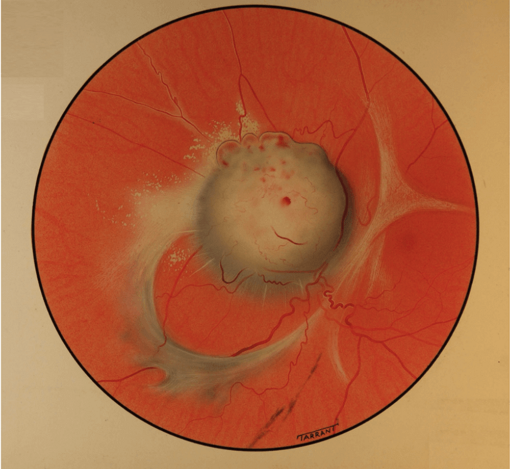 Art Of Ophthalmology