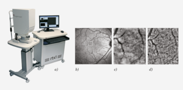 Figure 3.  (a) Imagine Eyes (b) shows a wide field fundus image from the right eye The white box indicates the area of the retina shown in panels (c) and (d)
